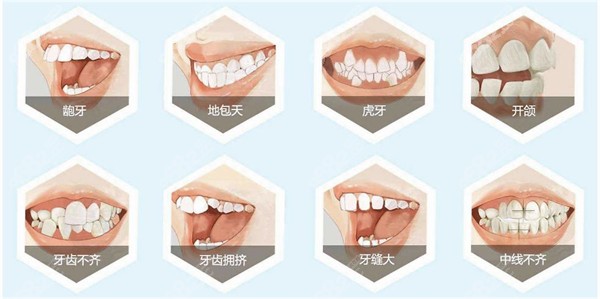 南京各牙科矫正牙齿的费用差别大不大
