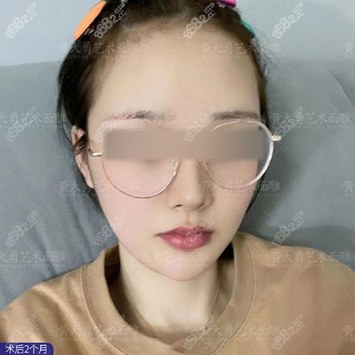 黄大勇做下颌角术后图片