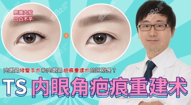 韩国TS内眼角疤痕重建术