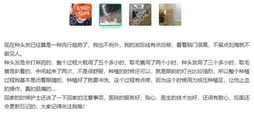 西安画美植发评价示意图