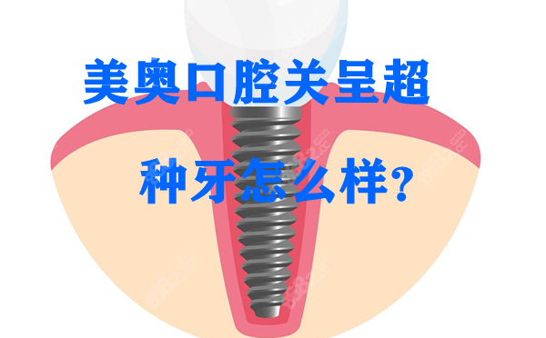 杭州美奥口腔关呈超种植牙怎么样