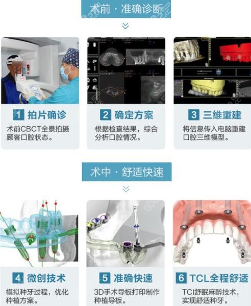 深圳福田微创种植牙流程