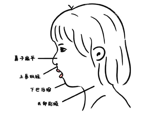 牙齿出现的问题不同矫正价格也不同哦