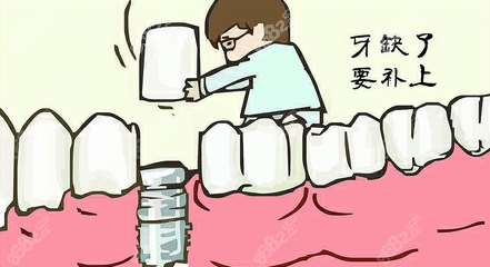 牙齿缺失后建议做种植牙