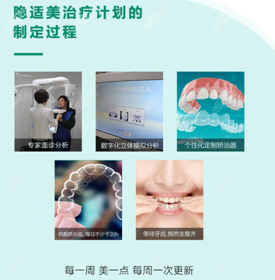 杭州美莱口腔医院隐适美矫正全过程
