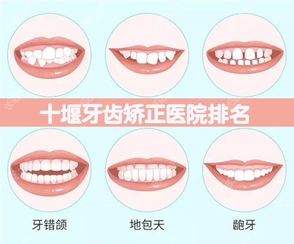 十堰牙齿矫正医院排名