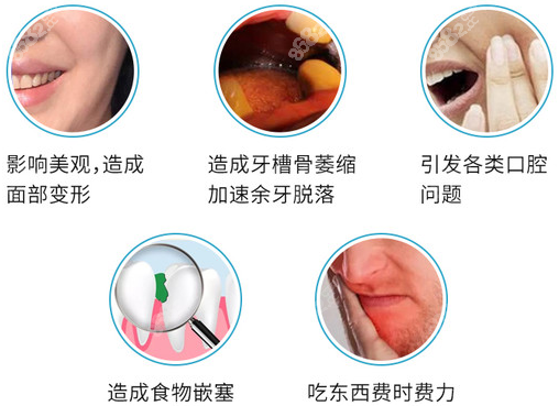 牙齿缺失危害