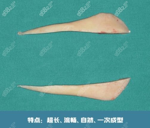 东篱医院长曲线下颌角