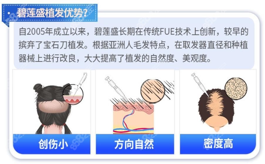 碧莲盛植发优势有哪些