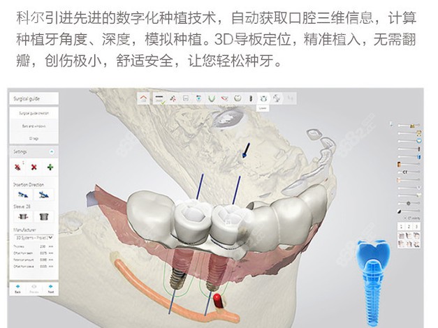 北京科尔口腔种植牙水平如何？哪个大夫种牙技术好？