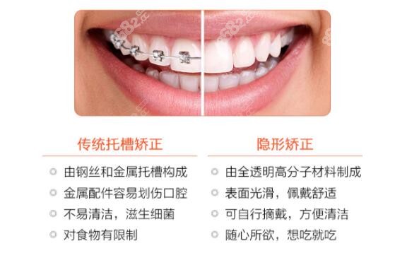 传统矫正和隐形牙套区别