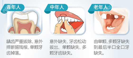 上海种植牙齿哪家医院比较好呢？