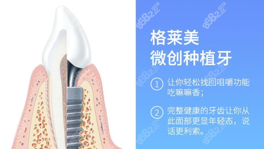 <!--<i data=20240705-sp></i>-->口腔医院种植牙优势