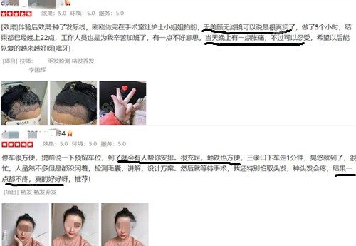 合肥曙光植发术后评价