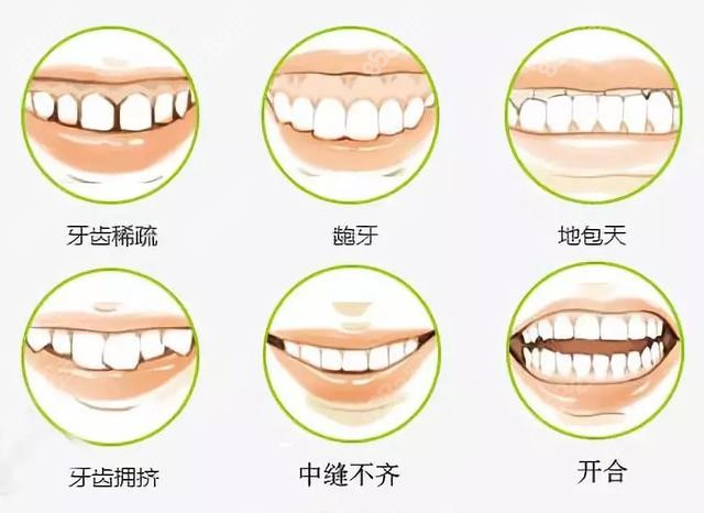 深圳龙岗牙科矫正牙齿收费价目表