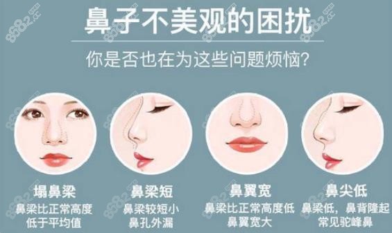 有鼻部困扰的朋友可以放心来西安美莱和壹加壹整形