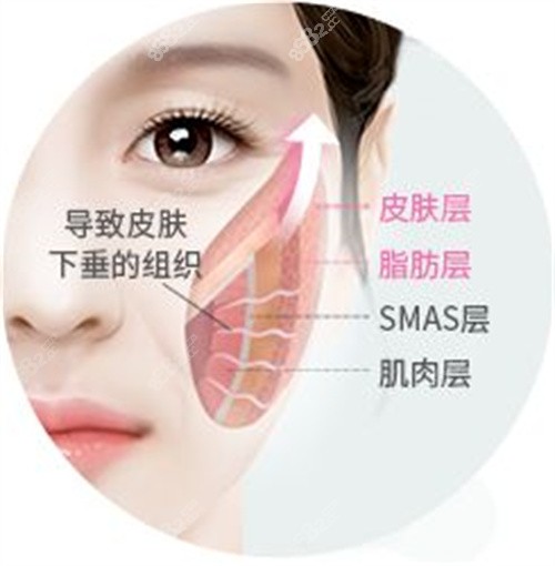 拉皮靠谱吗