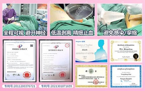 郝永生内窥镜隆胸优势