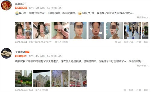 面部拉皮顾客评价