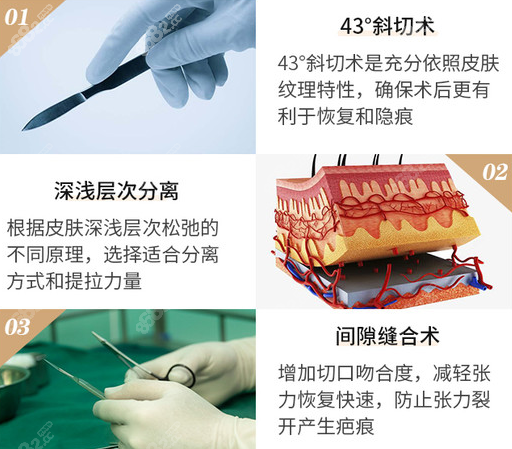 长沙希美整形拉皮手术技术