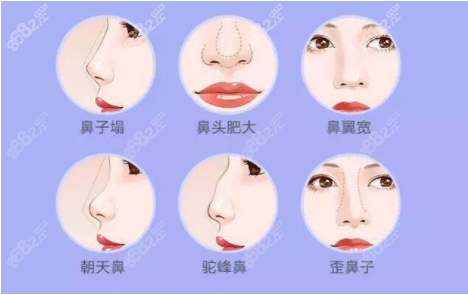 上海李鸿君做鼻子风格