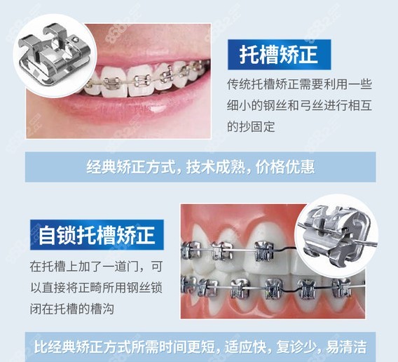杭州美奥牙齿矫正