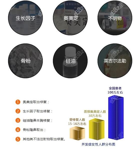 上海奧美定取出修復(fù)哪家醫(yī)院好