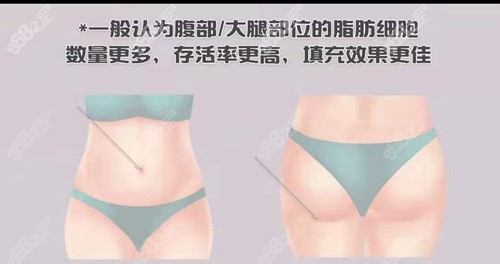 自體脂肪豐額頭成活率高嗎？