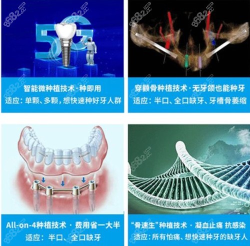 广州穗华数字化种植牙