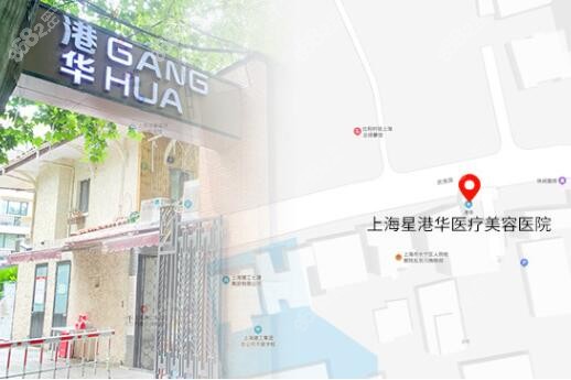上海港华医院做下颌角整形技术优势介绍
