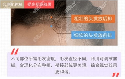 兰州碧莲盛植发靠谱吗