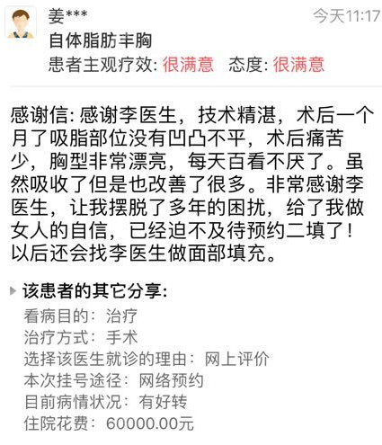 李发成自体脂肪填充胸部好评
