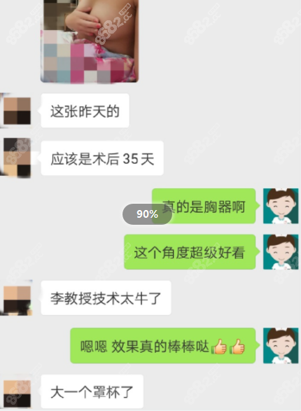 李发成脂肪填充胸部的好评反馈