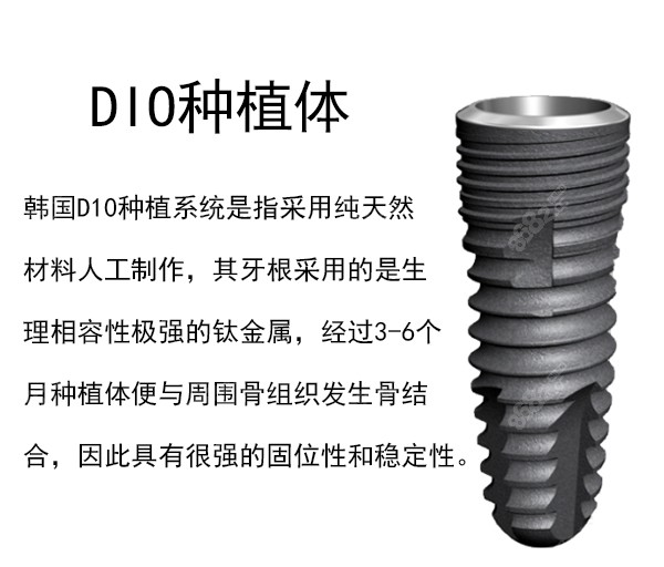 韩国DIO种植体的材质