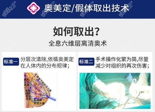 广州市荔湾区人民医院奥美定取出技术
