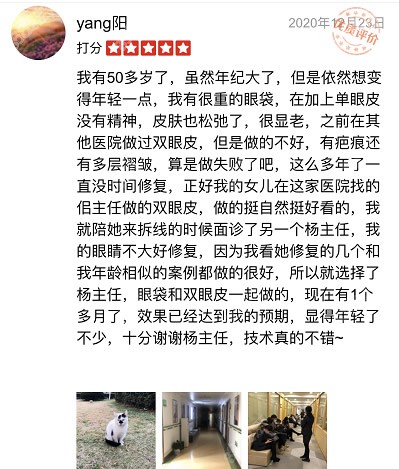 上海华美医生做双眼皮怎么样