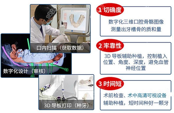 长沙美奥口腔种植优势