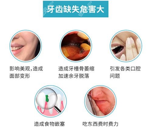 牙齿缺失危害