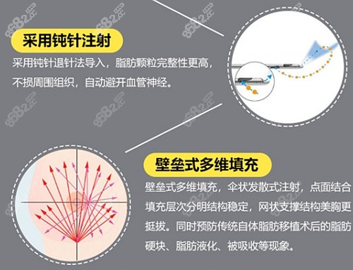 刘杰伟做自体脂肪隆胸的优势