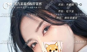 临沂东方美莱坞术后照片