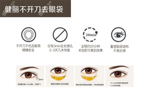 健丽不开刀去眼袋过程