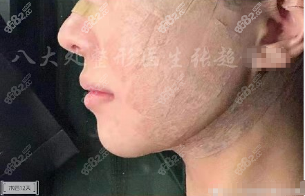 <!--<i data=20240705-sp></i>-->张超面吸图
