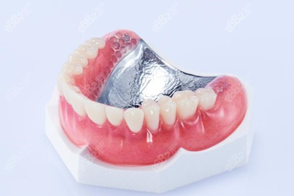 后牙活动义齿图片图片