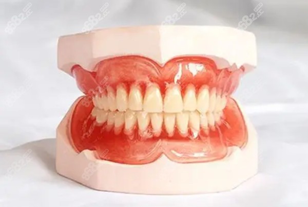 全口BPS吸附性义齿图片