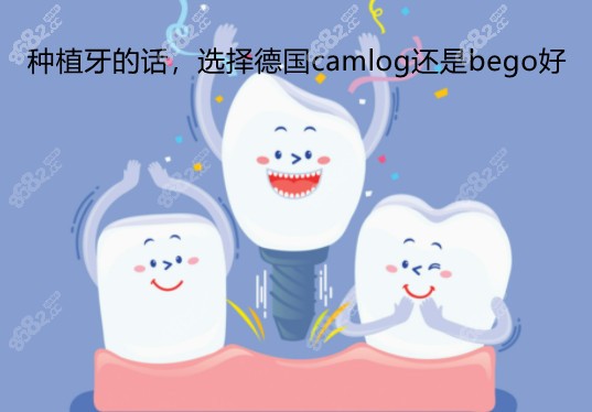 camlog和贝格相比哪个好