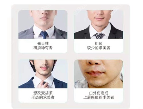 哪些人比较适合种植胡须