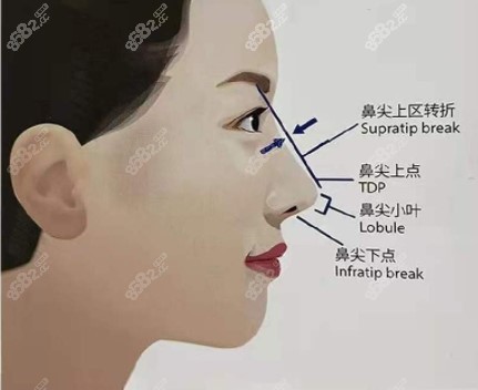 北京煤醫(yī)王英勇醫(yī)生做隆鼻審美參考 北京煤醫(yī)王英勇醫(yī)生做隆鼻審美參考