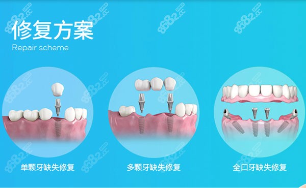 在武汉做半/全口种植牙的参考费用