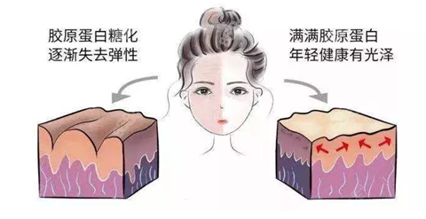 广州荔医整形热玛吉原理