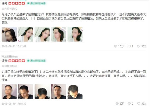 成都恒博植发评价